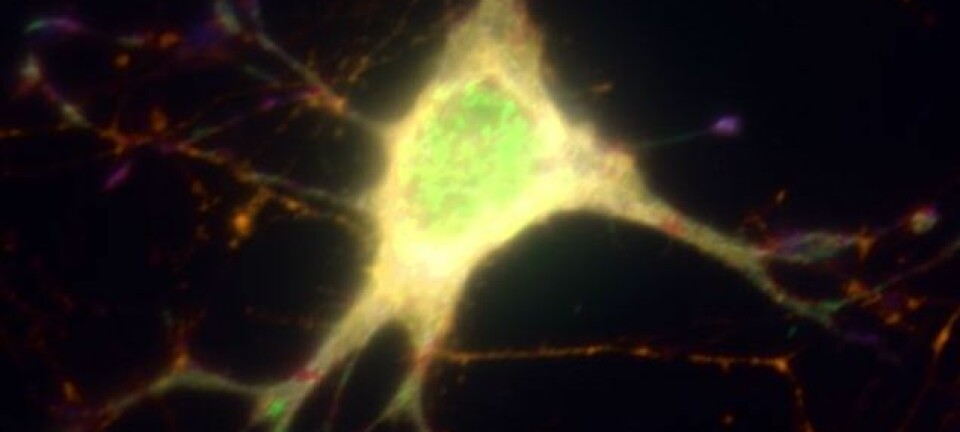 Ved å gjøre nerveceller lysfølsomme, kan forskerne aktivere utvalgte nerveceller i hjernen på forsøksdyr og øyeblikkelig se hvordan dyret reagerer. Foto: NorMIC