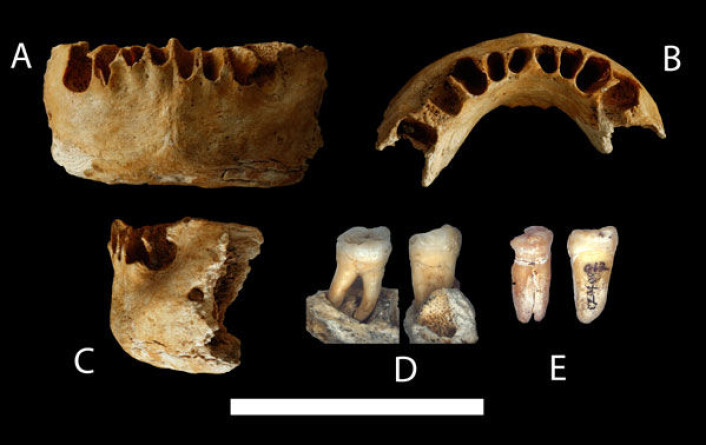 Underkjeve og to jeksler funnet i Zhirendong i Sør-Kina, datert til å være minst 100 000 år gamle, reiser nye spørsmål om når og hvordan moderne mennesker forlot Afrika og spredde seg i Eurasia. A, B og C er samme underkjeve sett fra ulike vinkler. D og E er to ulike jeksler fra ulike vinkler. Hvit stripe indikerer 5 cm. (Foto: Institute of Vertebrate Paleontology and Paleoanthropology (IVPP), Chinese Academy of Sciences) Underkjeve og to jeksler funnet i Zhirendong i Sør-Kina, datert til å være minst 100 000 år gamle, reiser nye spørsmål om når og hvordan moderne mennesker forlot Afrika og spredde seg i Eurasia. A, B og C er samme underkjeve sett fra ulike vinkler. D og E er to ulike jeksler fra ulike vinkler. Hvit stripe indikerer 5 cm. (Foto: Institute of Vertebrate Paleontology and Paleoanthropology (IVPP), Chinese Academy of Sciences)