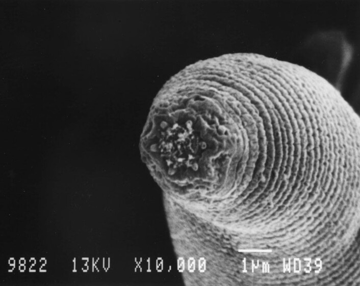 Denne ormen - en nematode - lever 1,3 km nede i jordskorpa i Sør-Afrika. (Foto: Gaetan Borgonie, Ghent University) Denne ormen - en nematode - lever 1,3 km nede i jordskorpa i Sør-Afrika. (Foto: Gaetan Borgonie, Ghent University)