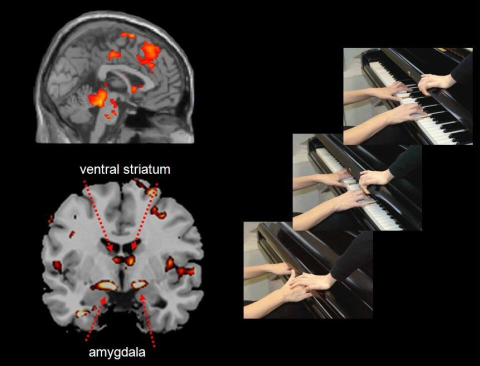 Når ungdom med aggressiv atferdslidelse så noen som påførte en annen smerte med vilje, for eksempel ved å smelle pianolokket over fingrene, aktiverte det hjerneregioner som behandler smerteinformasjon, samtidig som det aktiverte amygdala og ventral striatum - en del av nervekretsen som er involvert i belønning. Forskerne mener derfor at disse ungdommene ser ut til å nyte å se andre i smerte. (Illustrasjon: Decety/Lahey/Michaslska/Akitsuki)