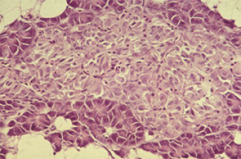 Histologisk snitt av bukspyttkjertel hos laks. (Foto: Anne Sundby) Histologisk snitt av bukspyttkjertel hos laks. (Foto: Anne Sundby)