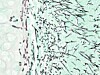 Dermatofyttinfeksjoner (hud -ringorm/tinea, negl- og hårinfeksjon)