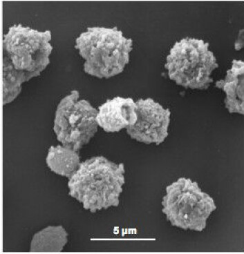 "Bildet viser sporer fra en slektning av muggsoppen Aspergillus fumigatus, nemlig aspergillus versicolor, sett gjennom elektronmikroskop. De fleste puster inn slike sporer hver dag, men svært få blir syke. (Foto: FHI, MIMI)" "Bildet viser sporer fra en slektning av muggsoppen Aspergillus fumigatus, nemlig aspergillus versicolor, sett gjennom elektronmikroskop. De fleste puster inn slike sporer hver dag, men svært få blir syke. (Foto: FHI, MIMI)"
