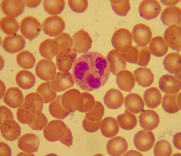 En nøytrofil granulocytt (brun, med tre rosa flekker) i mikroskopet. En nøytrofil granulocytt (brun, med tre rosa flekker) i mikroskopet.