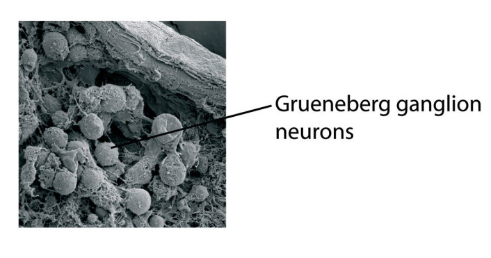 "Slik ser cellene i Gruenebergs ganglion ut gjennom elektronmikroskop. (Illustrasjon: Science/AAAS)" "Slik ser cellene i Gruenebergs ganglion ut gjennom elektronmikroskop. (Illustrasjon: Science/AAAS)"