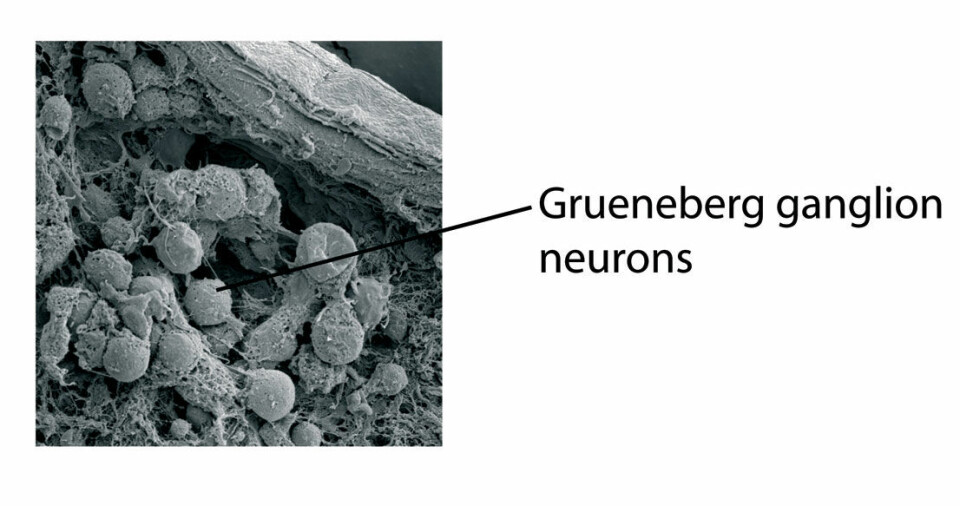 'Slik ser cellene i Gruenebergs ganglion ut gjennom elektronmikroskop. (Illustrasjon: Science/AAAS)'