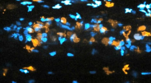 Se mikroskop-video av blodstrømmen hos levende sebrafisk