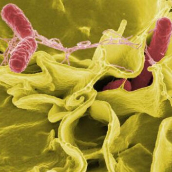 "Fargeforskerket motiv av Salmonella typhimurium (rød) som invaderer menneskecelle. Foto: National Institute of Allergy and Infectious Diseases of the NIH " "Fargeforskerket motiv av Salmonella typhimurium (rød) som invaderer menneskecelle. Foto: National Institute of Allergy and Infectious Diseases of the NIH "