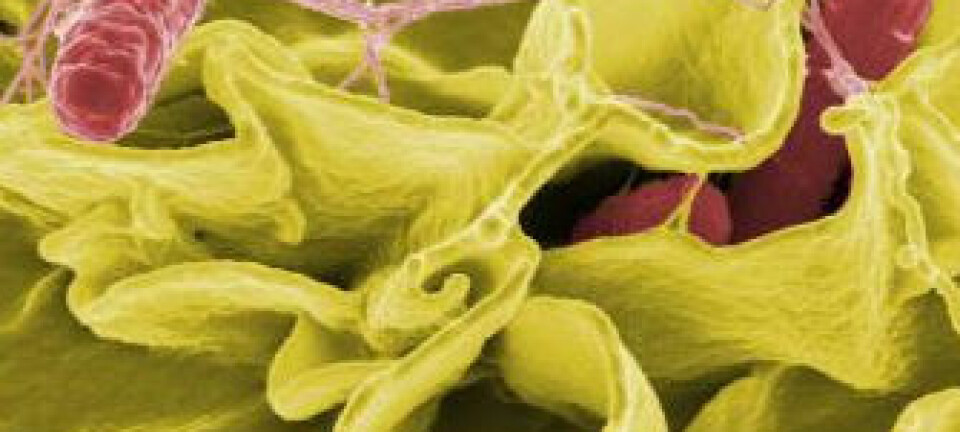 "Fargeforskerket motiv av Salmonella typhimurium (rød) som invaderer menneskecelle. Foto: National Institute of Allergy and Infectious Diseases of the NIH "