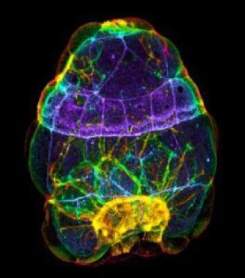 Ein 100 µm høg ormliknande mollusklarve. (Foto: Christiane Todt) Ein 100 µm høg ormliknande mollusklarve. (Foto: Christiane Todt)