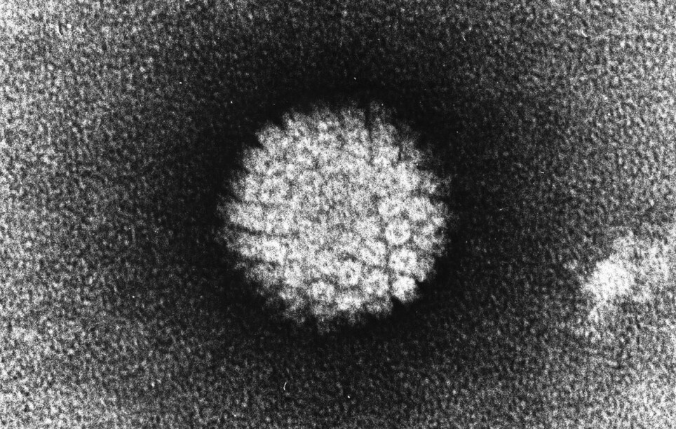 Årsaken til kreft i livmorhals er i over 99 prosent av tilfellene langvarig infeksjon med HPV-virus.
