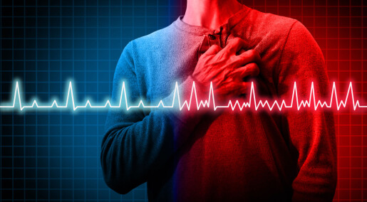Uoppdaget hjerte­flimmer var årsak til mange hjerneslag. Ni av ti hadde ingen symptomer
