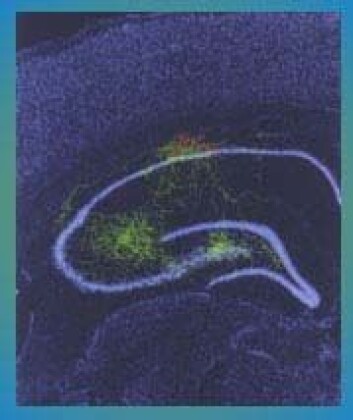 "Hippocampus er kritisk ved danning av nye minne." "Hippocampus er kritisk ved danning av nye minne."