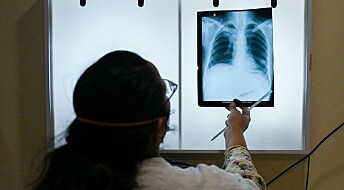 Tuberkulose er på fremmarsj