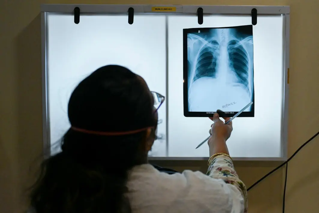 I 2021 økte forekomsten av antibiotikaresistent tuberkulose med 3 prosent. Bildet er fra et sykehus i Mumbai, der covid-19-pandemien gikk hardt utover kampen mot tuberkulose I 2021 økte forekomsten av antibiotikaresistent tuberkulose med 3 prosent. Bildet er fra et sykehus i Mumbai, der covid-19-pandemien gikk hardt utover kampen mot tuberkulose