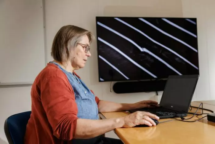 Seniorforsker Grete Bæverfjord har avdekket at ribbeinsbrudd er en årsak til melaninflekker.