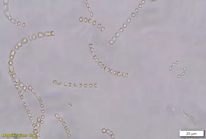 The species <span class="italic" data-lab-italic_desktop="italic">Skeletonema marinoi </span>has several of the properties needed to grow in wastewater. In addition, the species has a favorable nutritional profile that fits well with the salmon's needs. This is one of the species Borg-Stoveland will take a closer look at in his research