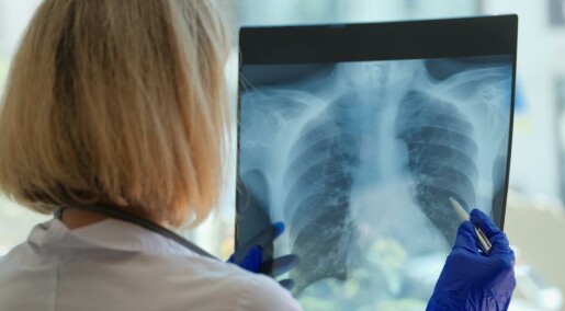 Blodprøver kan avsløre hvem som har risiko for å utvikle lungekreft hele ti år før diagnosen Blodprøver kan avsløre hvem som har risiko for å utvikle lungekreft hele ti år før diagnosen