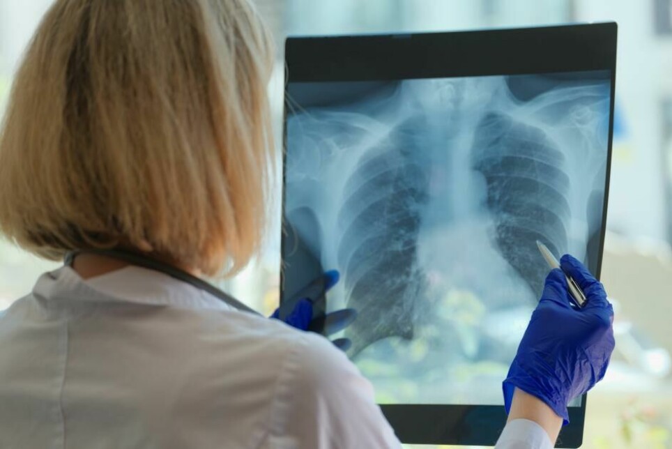 Dødeligheten ved lungekreft er høy fordi sykdommen ofte oppdages på et sent stadium.
