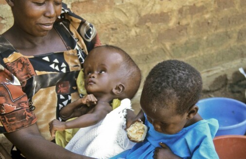 Infeksjoner er hovedårsaken til vannhode hos barn i Afrika