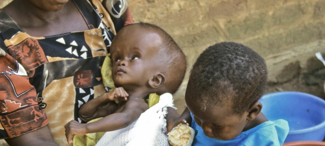 Infeksjoner er hovedårsaken til vannhode hos barn i Afrika