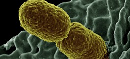 Risikoen for å få den skumle bakterien Klebsiella pneumoniaeer er høyere på sykehus enn fra gårdsdyr eller vann