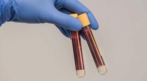 Syntetisk antistoff forenklar analyse av blodprøve