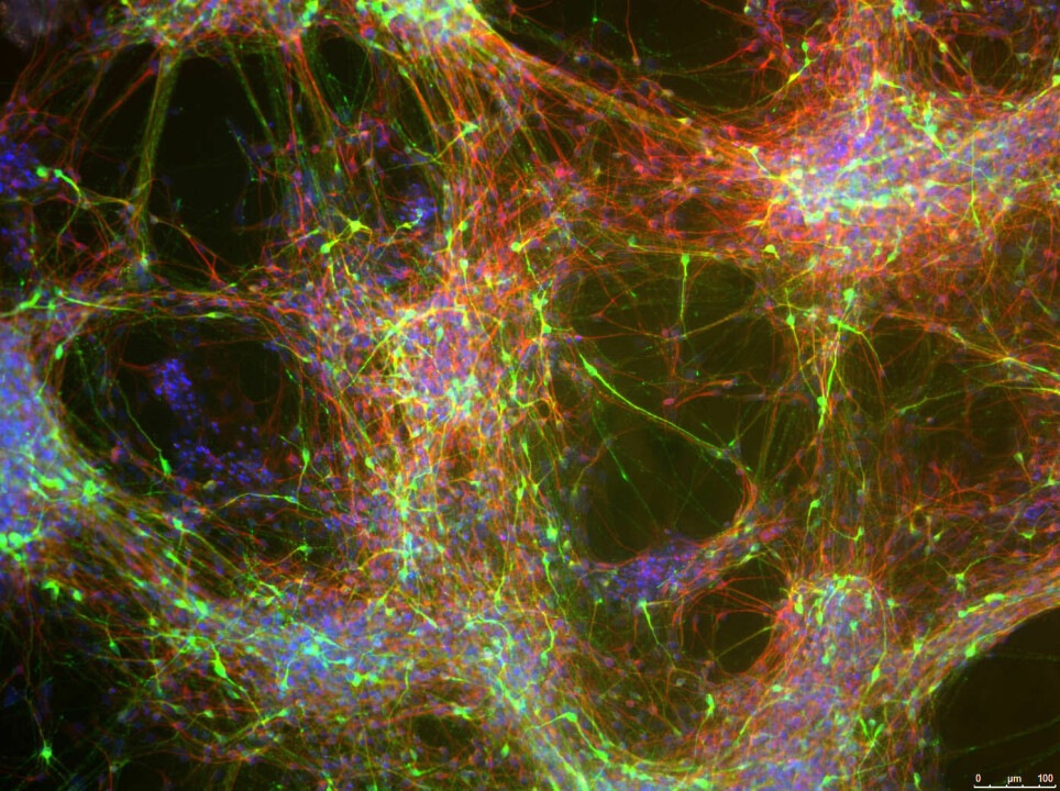 Bildet viser nerveceller som produserer dopamin. Fargene på bildet brukes til å skille mellom celler som produserer dopamin og andre celler.
