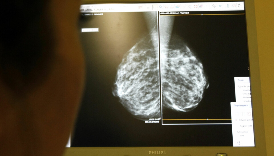 En lege studerer et mammografi-bilde, som brukes for å avdekke svulster i brystene.