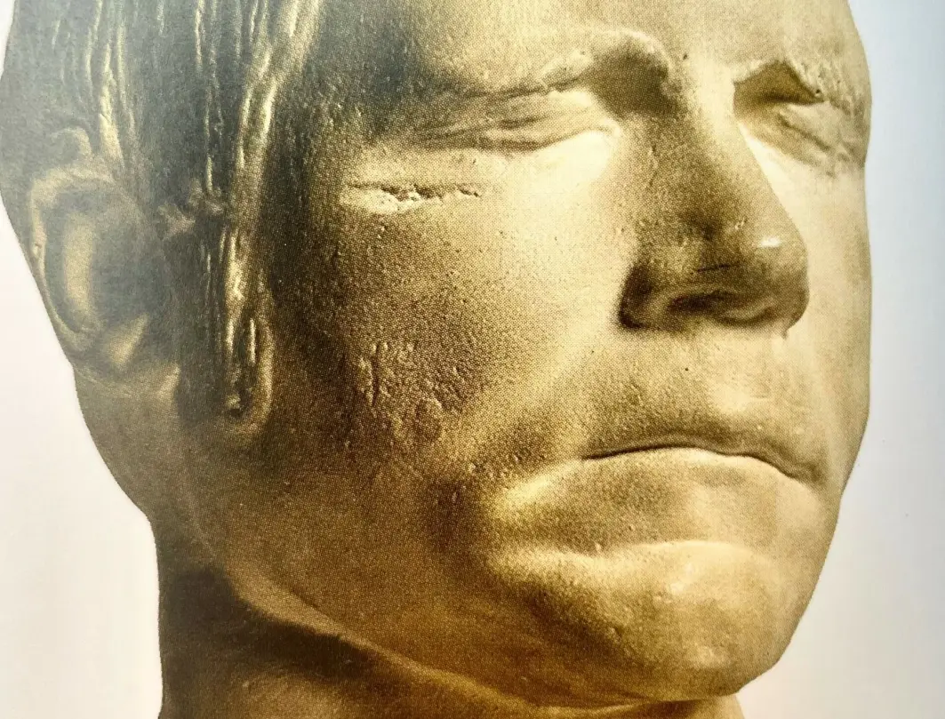 Etter at han ble henrettet, ble denne dødsmasken i gips laget av William Burkes hode. Den står utstilt på Surgeon´s Hall Museums i Edinburgh. Etter at han ble henrettet, ble denne dødsmasken i gips laget av William Burkes hode. Den står utstilt på Surgeon´s Hall Museums i Edinburgh.