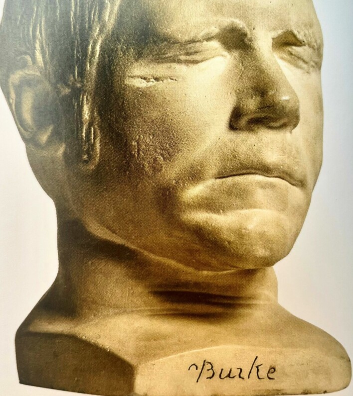 Etter at han ble henrettet, ble denne dødsmasken i gips laget av William Burkes hode. Den står utstilt på Surgeon´s Hall Museums i Edinburgh.