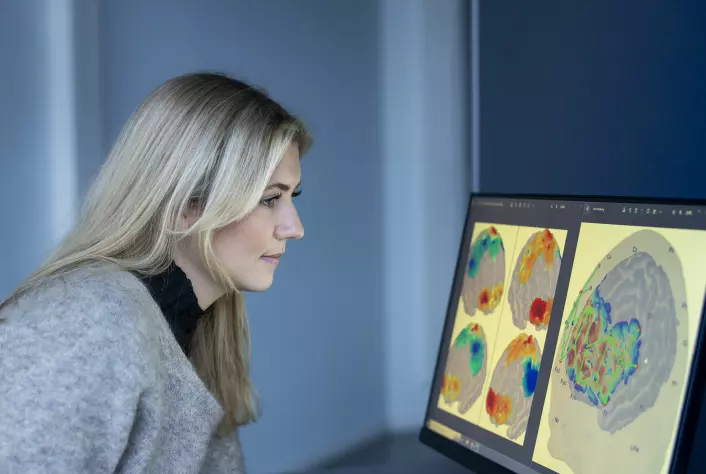 Signaler og blodstrømmer i hjernen blir registrert ved hjelp av flere ulike metoder. Resultatene kan forsker Sandra Klonteig studere på en skjerm.
