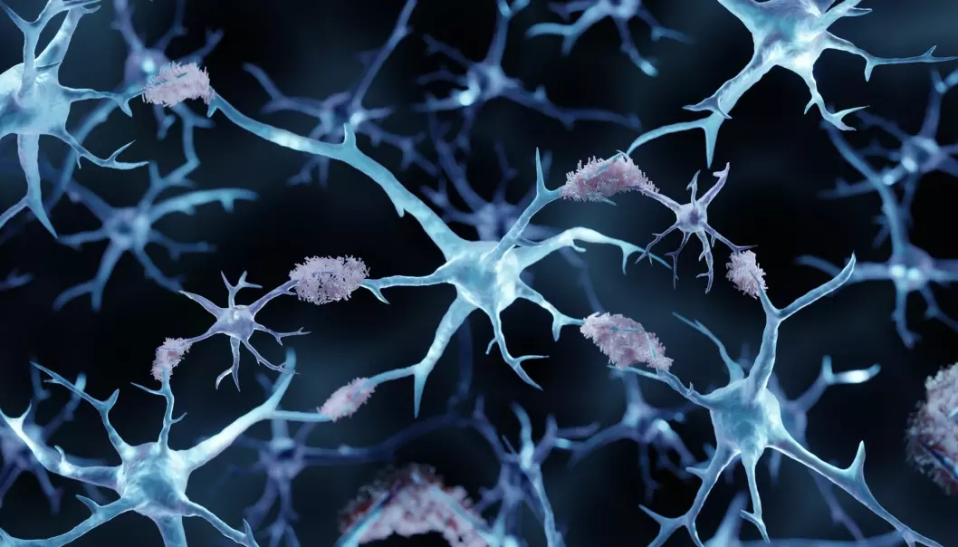 Hva fører til ansamlinger av proteiner og ødeleggelse av nerveceller i hjernen hos mennesker med Alzheimer? En ny studie antyder at tarmfloraen kan spille en viktig rolle.