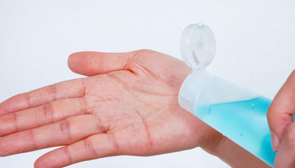 Rød, sprukken eller flassende hud er kjente bivirkninger av hyppig håndvask.