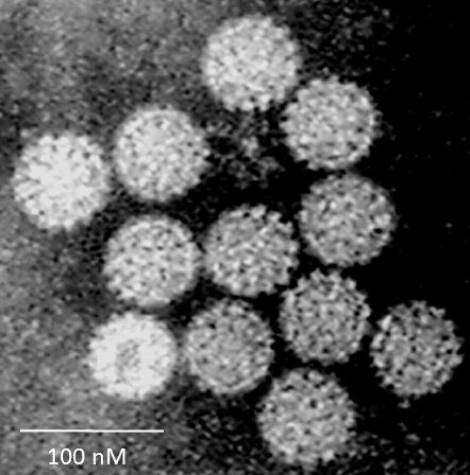 Bildet viser humant papillomavirus (HPV) med elektronmikroskop.