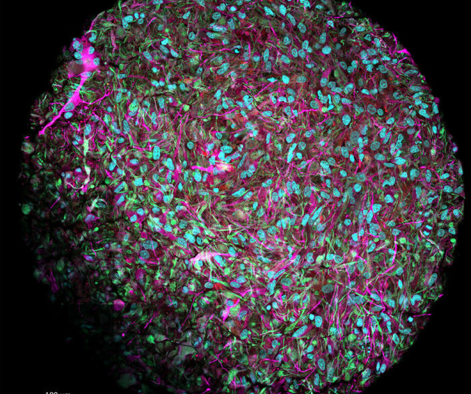 Bildet viser cellene i en minihjerne. Nevronene er farget lilla, mens de blå flekkene viser cellekjerner. De røde og grønne delene viser støtteceller. Minhjernene har en del av de viktige strukturene og funksjonene som man finner i en ekte hjerne.