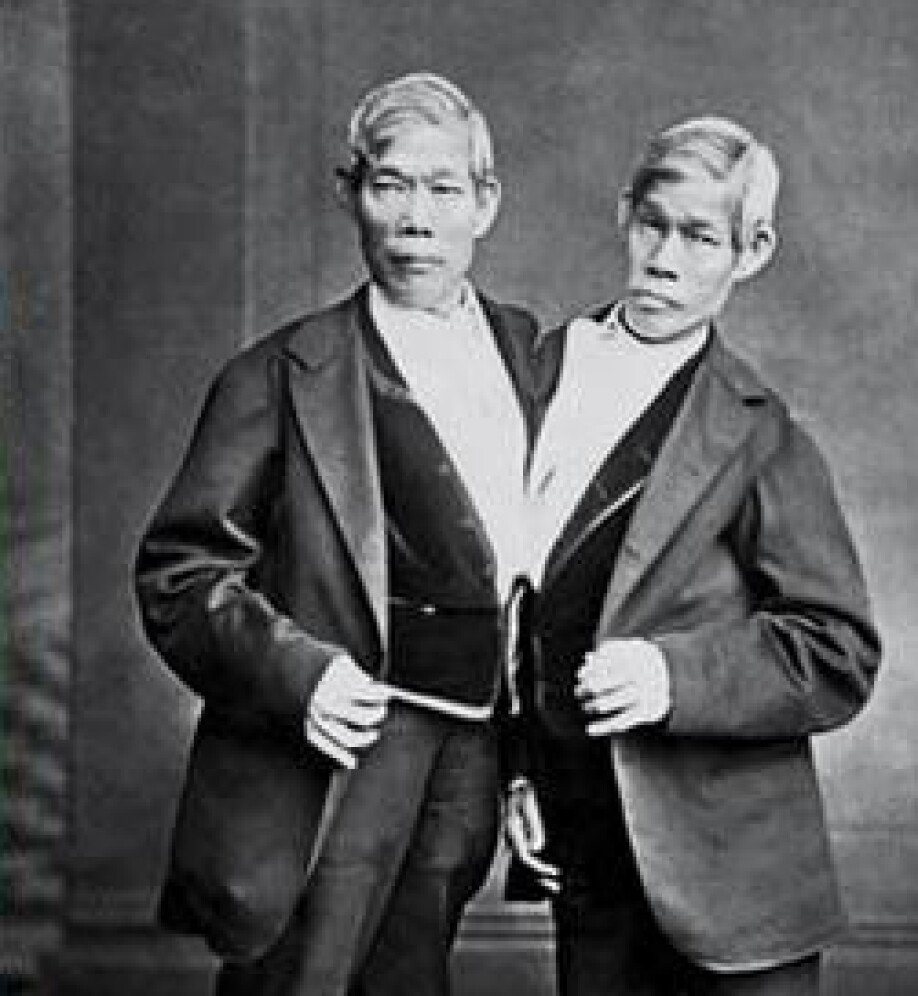 Ordet «siamesiske tvillinger» kommer fra to sammenvokste tvillingbrødre. Chang og Eng ble født i Siam, Thailand i dag, i 1811. Begge giftet seg og fikk mange barn.