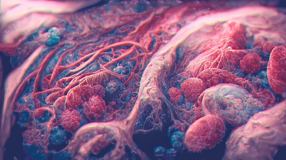Kunstnerisk illustrasjon av kreft i kroppen.