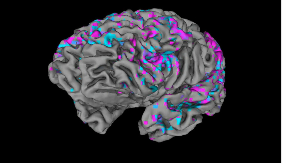 fMRI måler blodgjennomstrømning i hjernen. Det viser hvor det er mer og mindre aktivitet enn vanlig.