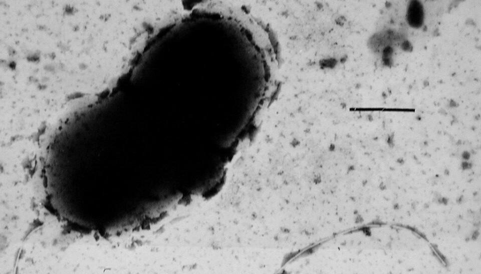 Forskere har sett nærmere på om bakterien Desulfovibrio kan ha noe å gjøre med Parkinsons sykdom.