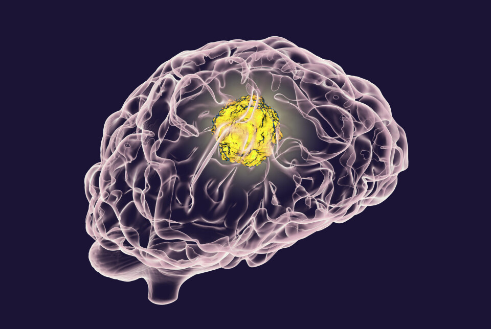 Forskere leter etter bedre behandlinger mot hjernekreft.