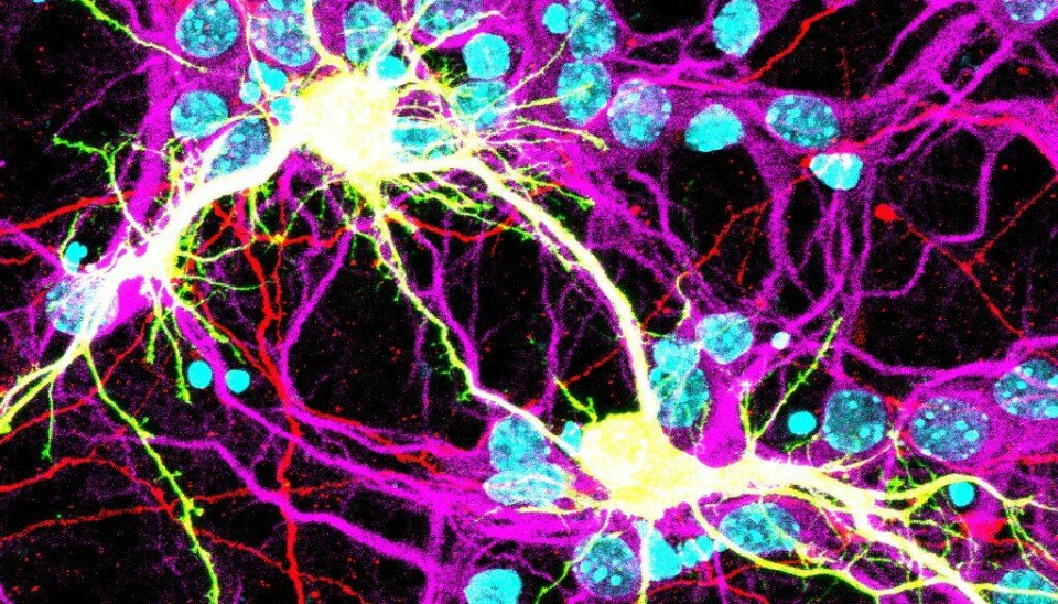 To hjerneceller har blitt til én (farget i gul) i en musehjerne. Her er det de lange armene til cellen som har koblet seg sammen.