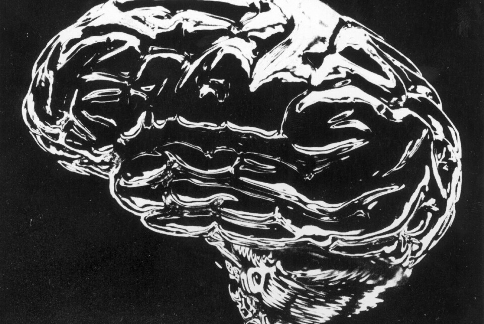 En ny nederlandsk studie bruker datateknologi og kunstig intelligens, og tolker hjernens signaler om til tale. Det virker svært lovende, og kan trolig bidra til verdifulle hjelpemidler for pasienter i fremtiden, mener norsk hjerneforsker. Foto: NTB