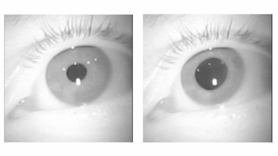 The eye of an elite rower while sitting still (left) and while using a rowing ergometer (right).