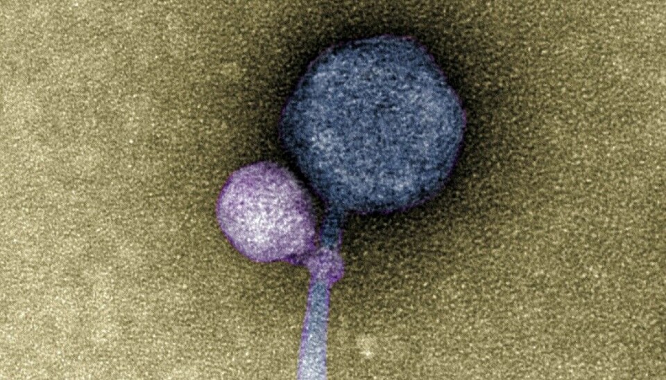 Det lille viruset (farget i lilla) kalles et satelittvirus. Det har hektet seg på et annet virus (farget i blått). Bildet er tatt med med et kraftig elektronmikroskop.