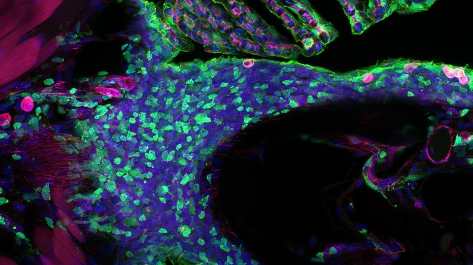 Bildet viser NELO i genetisk modifisert sebrafisk. I denne fisken er cellene som er aktive i visse immunaktiviteter endret til å produsere et protein som lyser grønt når det blir belyst med laser. Tilsvarende kan du også se cellenes DNA (blå) og viktige deler av cytoskjelettet (rosa). Den hvite streken er 30 mikrometer.