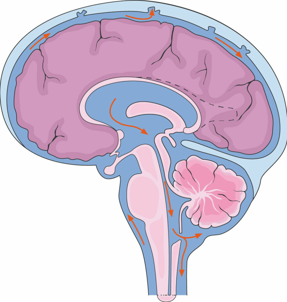 Illustrasjon av en hjerne i lilla med blå væske i et hulrom i midten, rundt hjernen og nedover ryggraden.