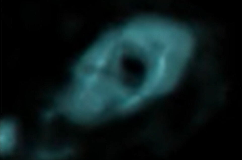 Et MR-bilde viser en smultringformet lys ring med et svart hull i midten.