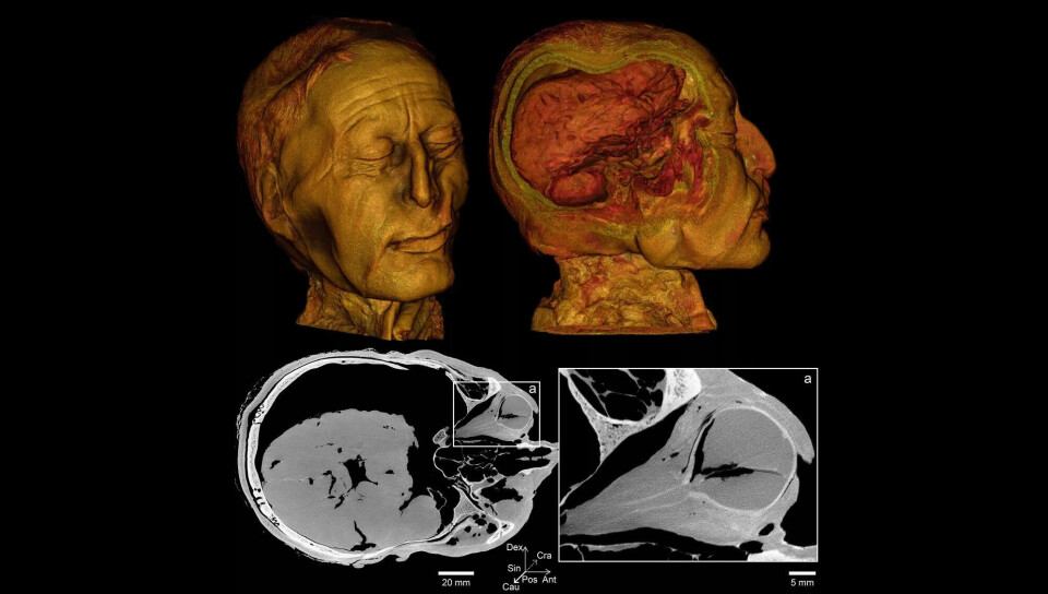 Gulbrunt hode i halvprofil og i profil. På profilbildet ser vi hjernen. Under: Svart-hvitt-skanning som viser det ene øyet som en kule.