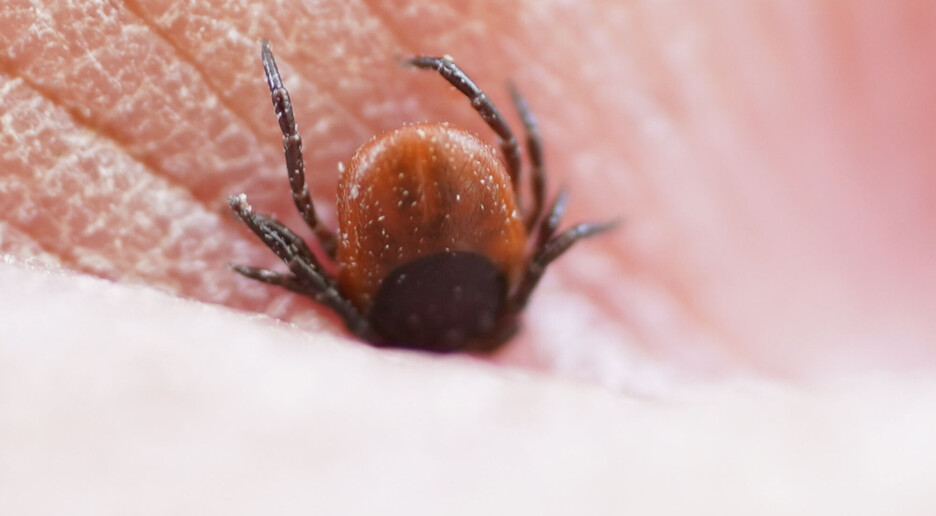 Flåttsenteret ønsker flere bilder av hudutslett etter flåttbitt